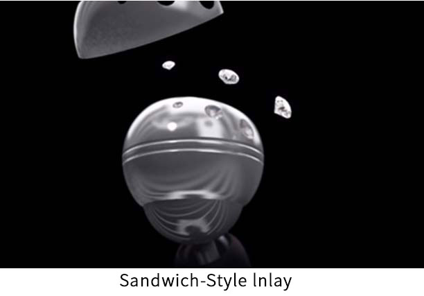 Sandwich inlay